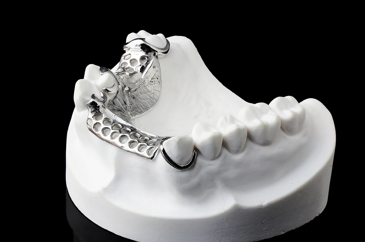 Dentures Hdmdental co uk Dentures Hdmdental co uk